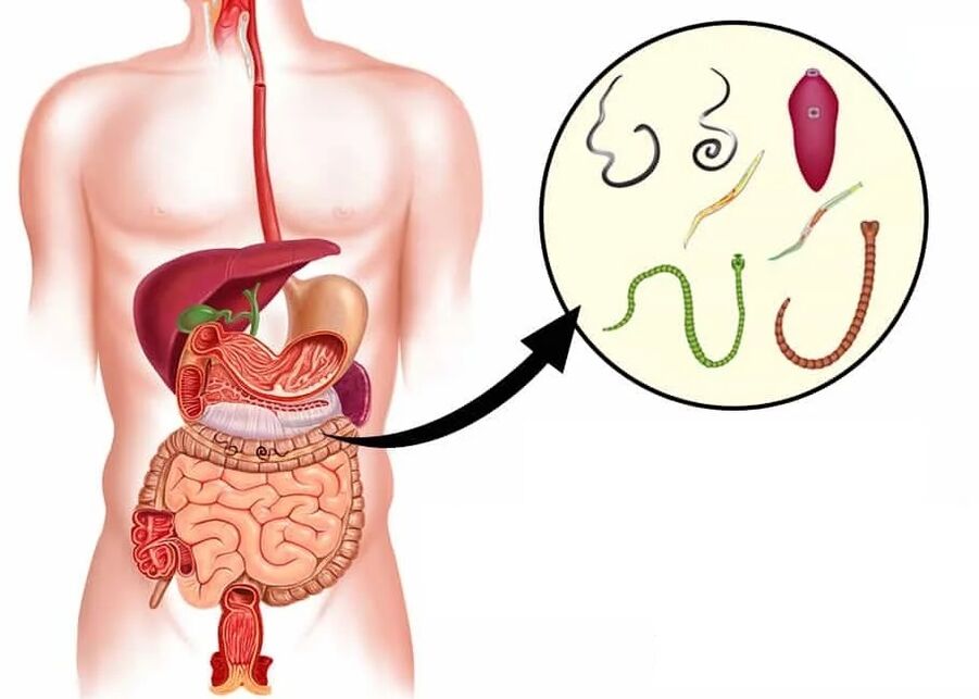 Vermixin-ek helminto mota gehienekin laguntzen du