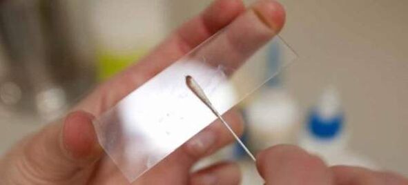 Zizare arrautzak arrastatzea